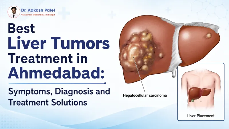 Best Liver Tumors Treatment In Ahmedabad Symptoms Diagnosis And Treatment Solutions — Dr. Aakash Patel