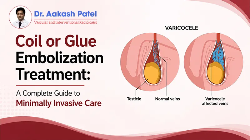 Coil or Glue Embolization Treatment: A Complete Guide to Minimally Invasive Care — Dr. Aakash Patel