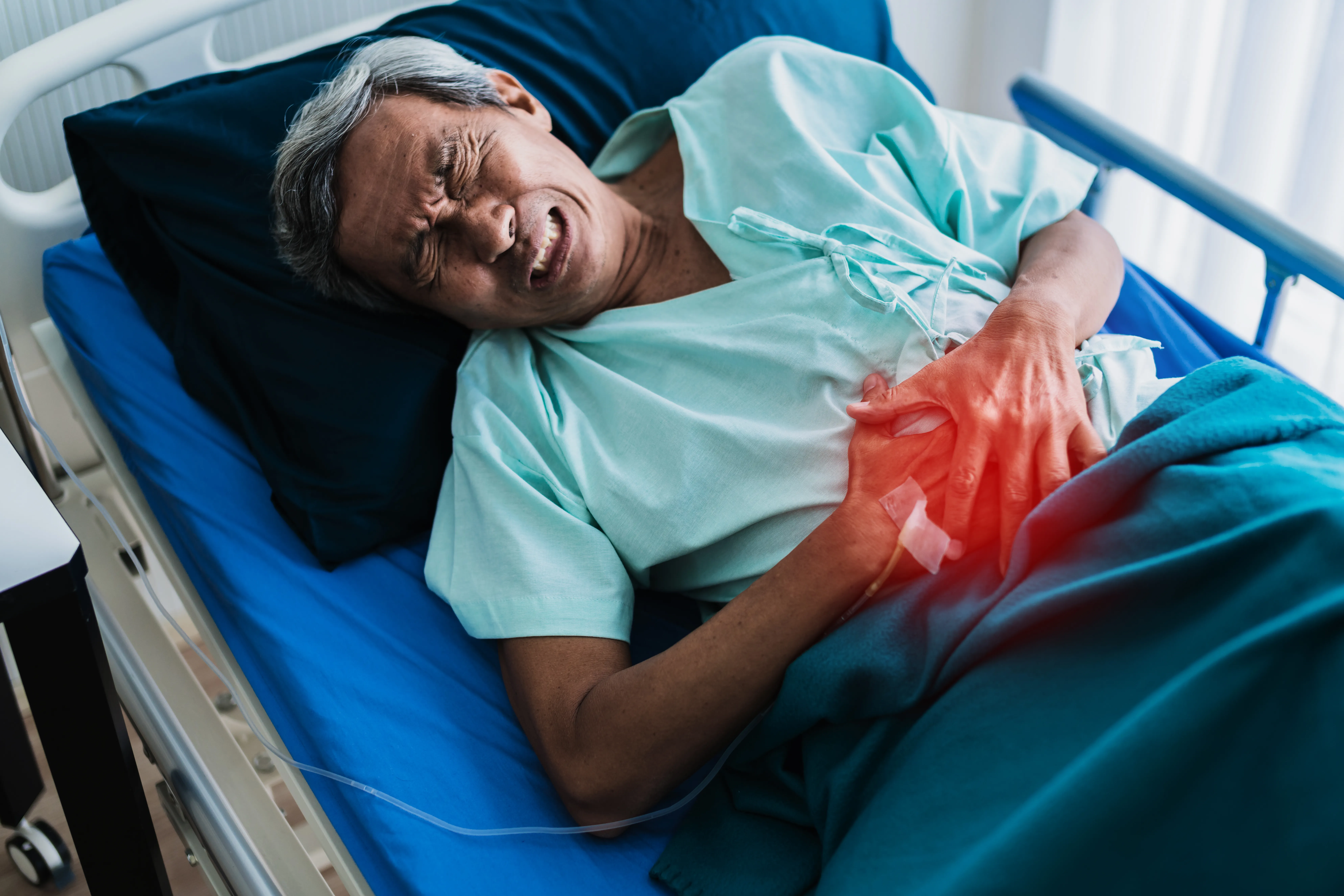 Coil or Glue Embolization Treatment – A Complete Patient Guide
