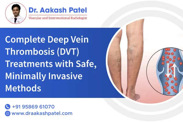 Complete Deep Vein Thrombosis (DVT) Treatments with Safe, Minimally Invasive Methods