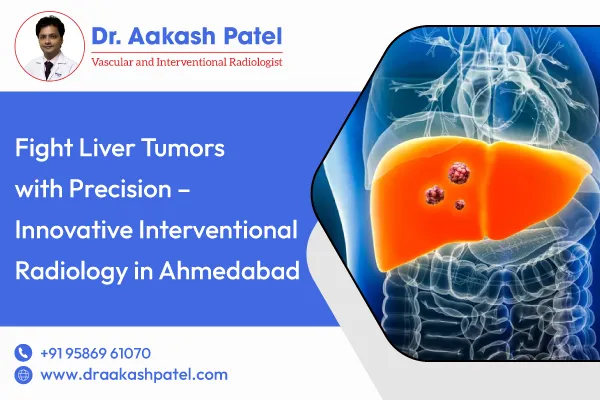 Fight Liver Tumors with Precision – Innovative Interventional Radiology in Ahmedabad