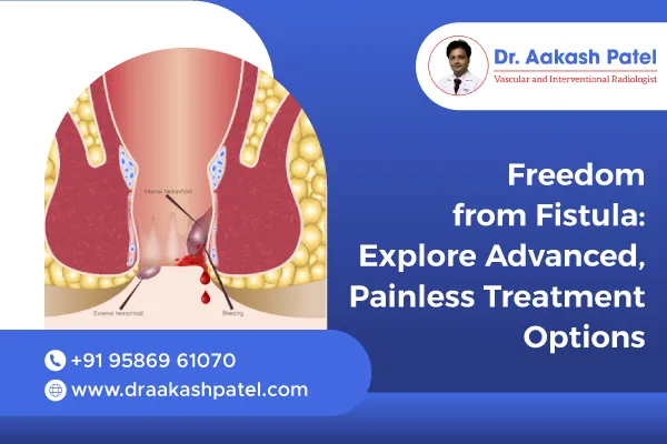 Freedom from Fistula: Explore Advanced, Painless Treatment Options