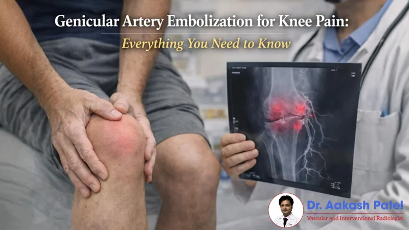 Genicular Artery Embolization for Knee Pain: Everything You Need to Know – Dr. Aakash Patel