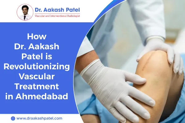 How Dr. Aakash Patel is Revolutionizing Vascular Treatment in Ahmedabad