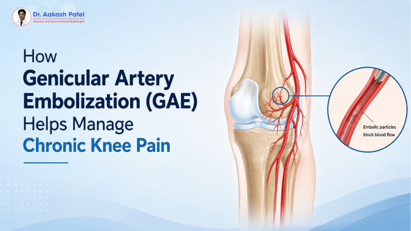 How Genicular Artery Embolization (GAE) Helps Manage Chronic Knee Pain — Dr. Aakash Patel