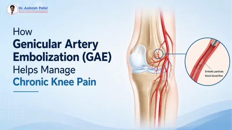 How Genicular Artery Embolization (GAE) Helps Manage Chronic Knee Pain — Dr. Aakash Patel