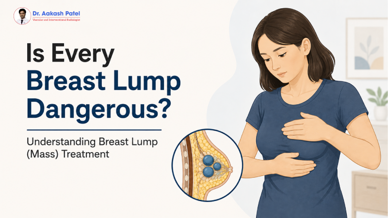 Is Every Breast Lump Dangerous? Understanding Breast Lump (Mass) Treatment — Dr. Aakash Patel