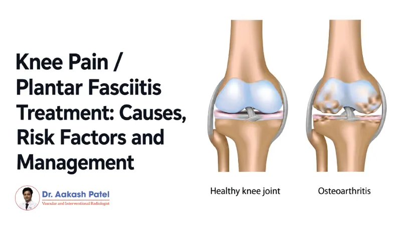 Knee Pain Plantar Fasciitis Treatment Causes Risk Factors And Management — Dr. Aakash Patel