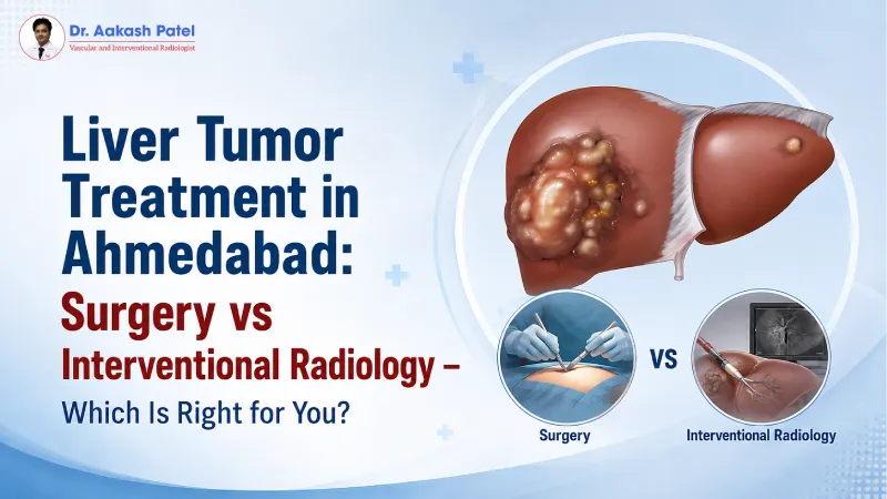 Liver Tumor Treatment in Ahmedabad: Surgery vs Interventional Radiology – Which Is Right for You? — Dr. Aakash Patel