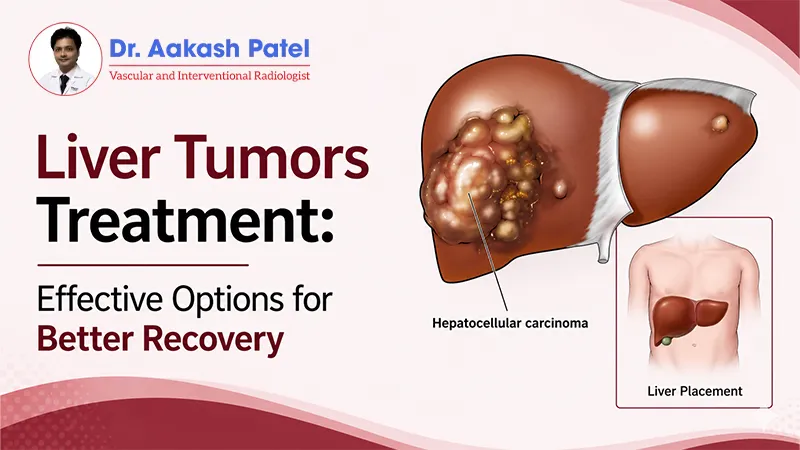 Liver Tumors Treatment: Effective Options for Better Recovery — Dr. Aakash Patel