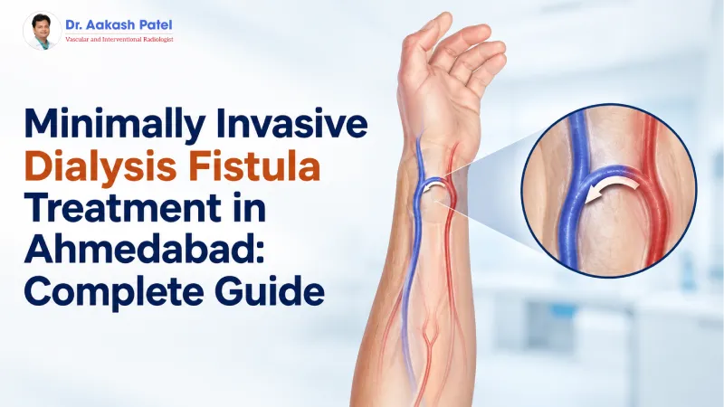 Minimally Invasive Dialysis Fistula Treatment in Ahmedabad: Complete Guide