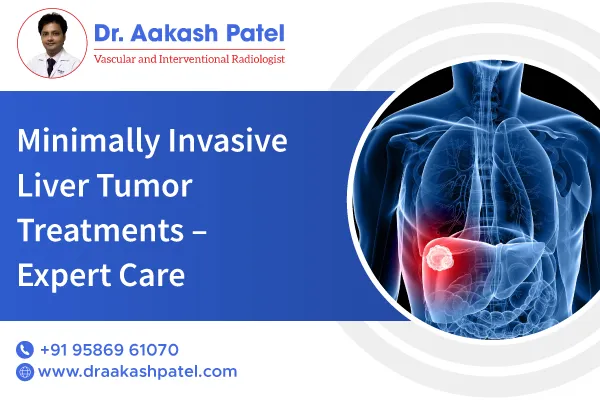Minimally Invasive Liver Tumor Treatments – Expert Care
