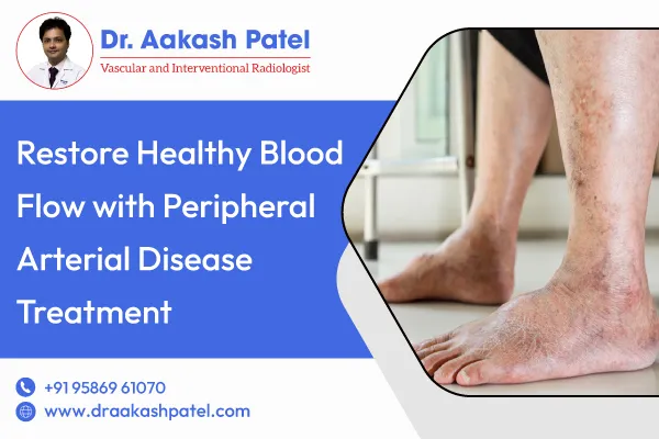 Restore Healthy Blood Flow with Peripheral Arterial Disease Treatment