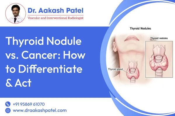 Thyroid Nodule vs. Cancer: How to Differentiate & Act – Dr. Aakash Patel