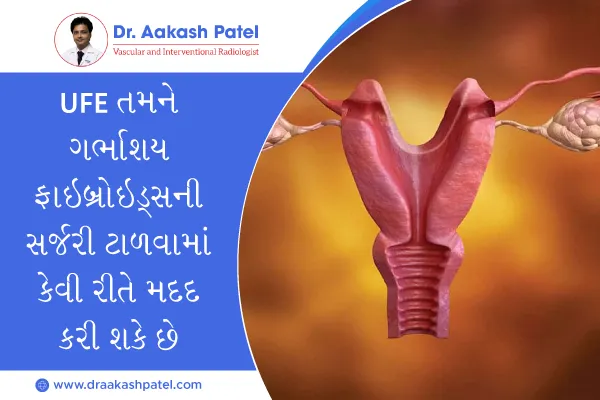 UFE તમને ગર્ભાશય ફાઇબ્રોઇડ્સની સર્જરી ટાળવામાં કેવી રીતે મદદ કરી શકે છે