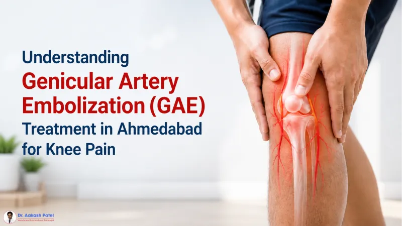 Understanding Genicular Artery Embolization Gae Treatment In Ahmedabad For Knee Pain — Dr. Aakash Patel