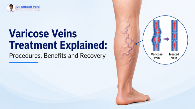 Varicose Veins Treatment Explained: Procedures, Benefits and Recovery — Dr. Aakash Patel