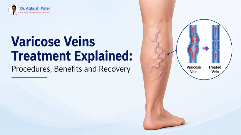 Varicose Veins Treatment Explained: Procedures, Benefits and Recovery — Dr. Aakash Patel