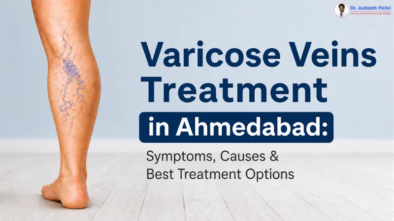 Varicose Veins Treatment In Ahmedabad Symptoms Causes Best Treatment Options — Dr. Aakash Patel